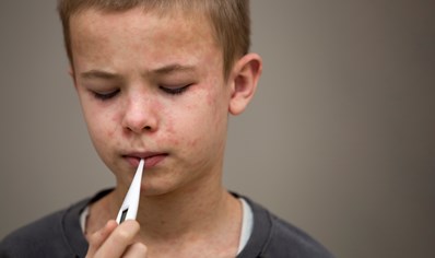 what-to-know-about-measles-signs-and-symptoms image