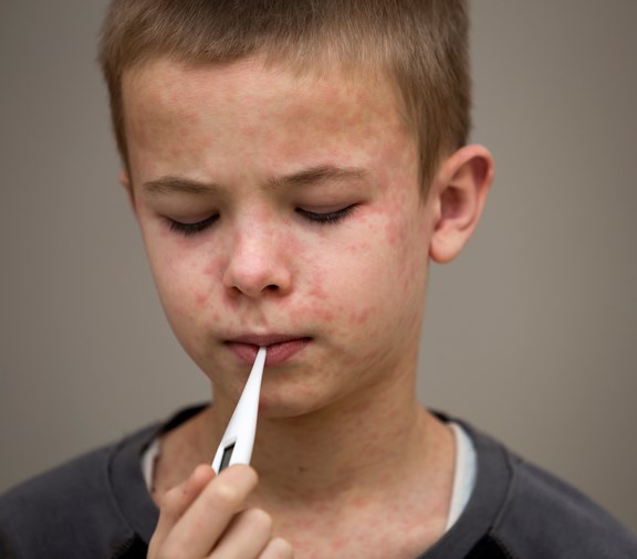 Young boy with fever and in pain from measles